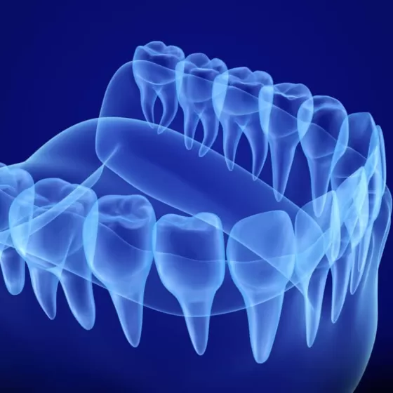 I don't have a scanned file, but I have 3d printed models of my teeth. Can you use those?